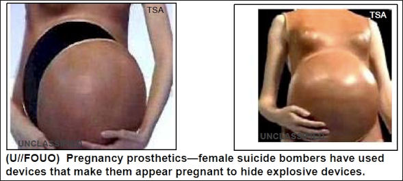 20120709-Pregnancy_prosthetics.jpg